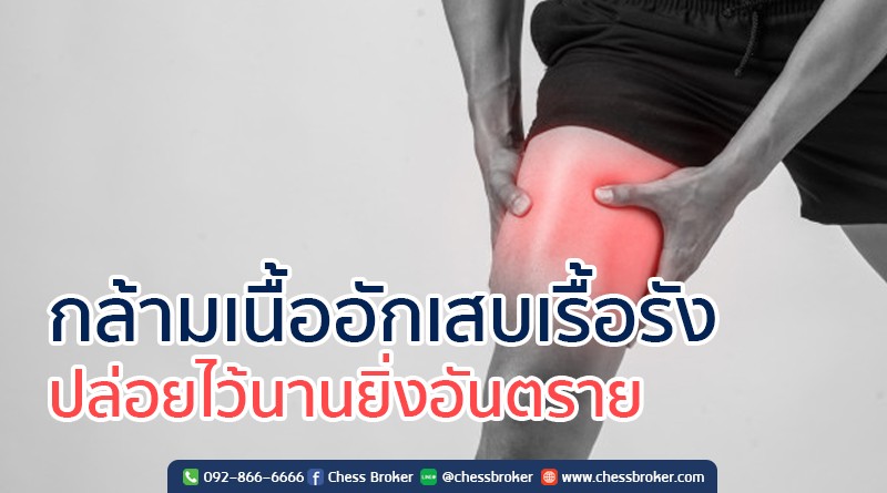 ประกันอุบัติเหตุส่วนบุคคล